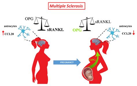 Cells Free Full Text Rank Rankl Opg Axis In Multiple Sclerosis The