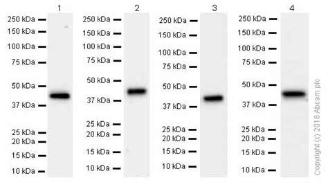 Recombinant Anti Aldolase Aldolase B Aldolase C Antibody Epr B