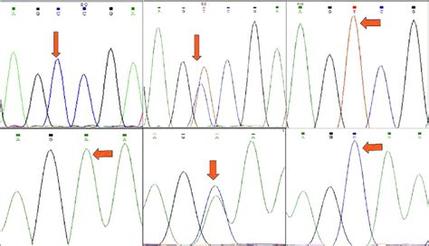 Representative Sequencing Chromatogram Profiles Of Controlscases Download Scientific Diagram