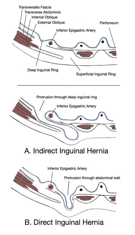 Anatomy Of The Inguinal Region - ANATOMY