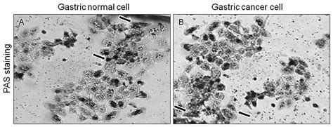 A Method For Establishing Human Primary Gastric Epithelial Cell Culture