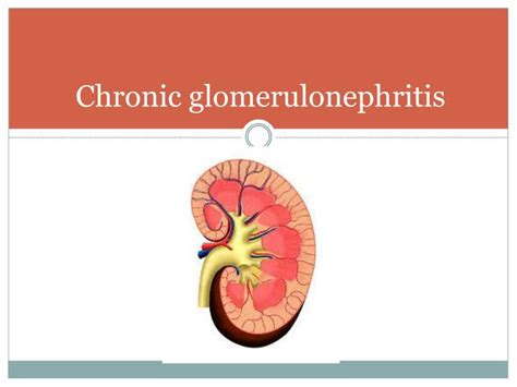 Ppt Introduction To Nephrology Acute And Chronic Glomerulonephritis