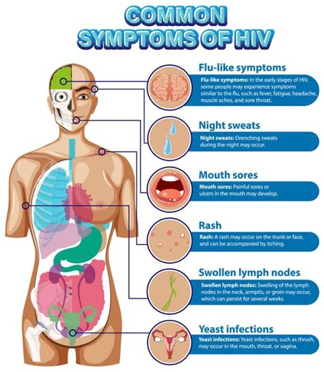 Swollen Lymph Nodes Hiv