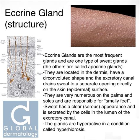 Global Dermatology » Eccrine Gland (structure) (Instagram)