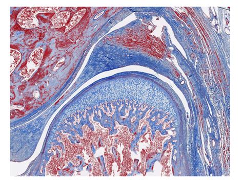 Diagram Of Tmj Histology Quizlet