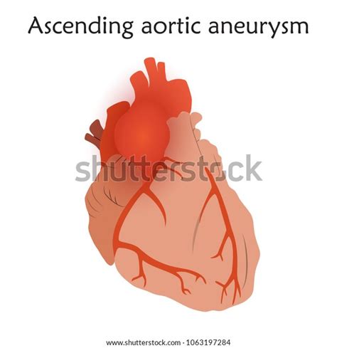 Ascending Aorta Anatomy - Anatomy Reading Source