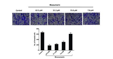 Invasion Assay Of A549 Cell Line Showing Inhibition Of The Metastasis Download Scientific