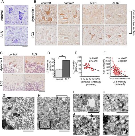 PDF Dnc 1 Dynactin 1 Knockdown Disrupts Transport Of Autophagosomes