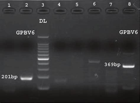 Reverse Transcription Polymerase Chain Reaction Rt Pcr Showing