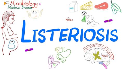 Listeriosis (disease) | Listeria Food Poisoning | Microbiology 🧫 ...