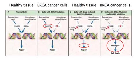 Use Of PARP Inhibitors In Ovarian Cancer Cancer World Archive