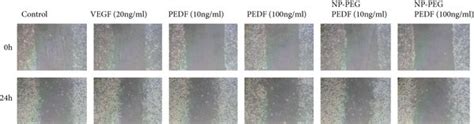 Cell Scratch Test Results Effects Of Pedf And Np Peg Pedf On Huvec