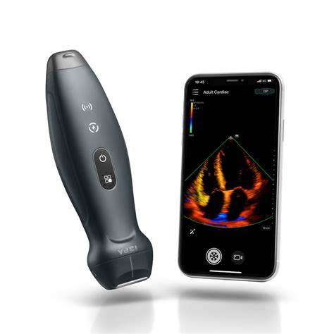 mindray official  store  handheld ultrasound system mindray