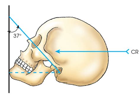 Chapter 11 Cranium Long Merrills Atlas Of Radiographic Positioning