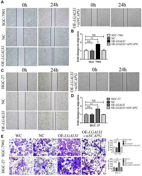 Galectin Mediated High Ncapg Expression Correlates With Poor