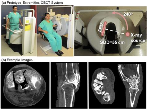 A The Prototype CBCT Scanner For Musculoskeletal Extremity Imaging