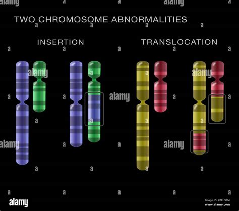 Chromosome Translocation Hi Res Stock Photography And Images Alamy