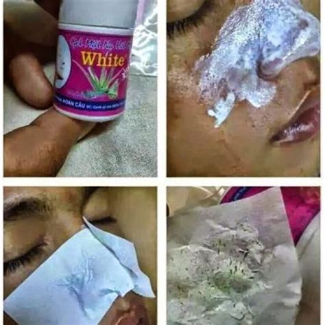 Vietnam Blackhead Removal Porestrip Gel Mat Na Hut Mun White Beauty