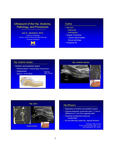 Ultrasound of the Hip: Anatomy, Pathology, and Procedures - DocsLib