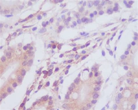 Map Lc A Rabbit Mab Sab Signalway Antibody