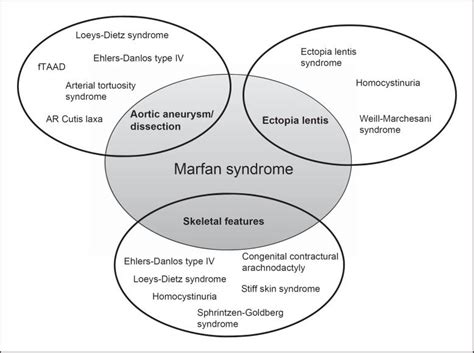 Genetic Dissection Of Marfan Syndrome And Related Connective Tissue