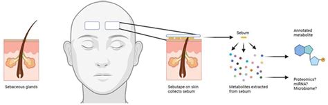 Pos0814 Untargeted Metabolomics Analysis Of Sebum A Non Invasive