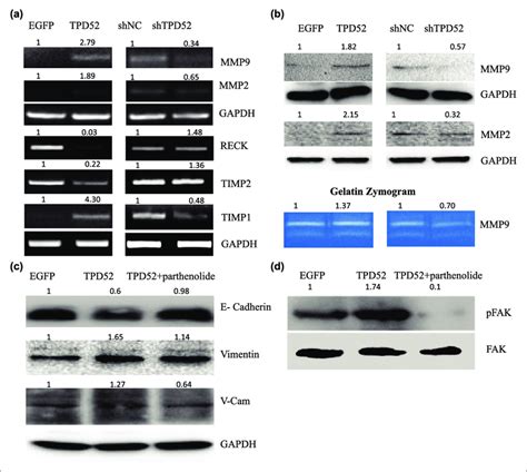 A Rt Pcr Analysis Of Mmp And Timp Expression In Lncap Cells With