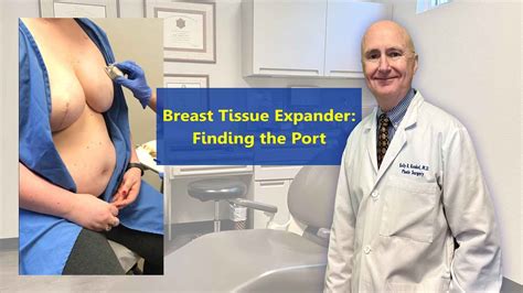 Breast Tissue Expander Locating The Port To Add Saline Youtube