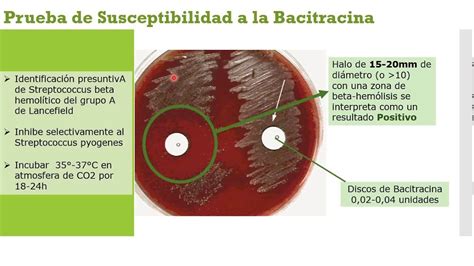 Genero Streptococcus Mapa Mental