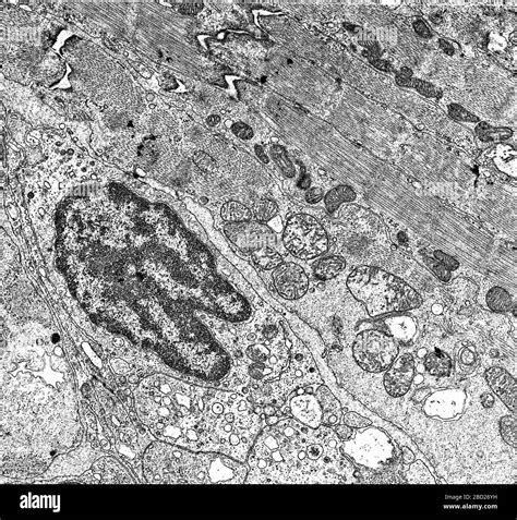 Cell nucleus electron microscopy fotografías e imágenes de alta