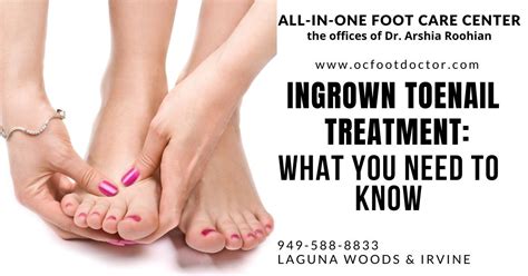 Ingrown Toenail Treatment: What You Need To Know