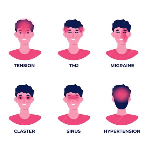 Tipos De Dor De Cabeça Em Diferentes áreas Do Conjunto De Cabeça Do Paciente Vetor Premium