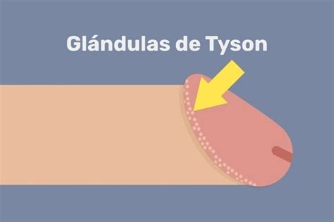 Tengo Unos Granitos En El Pene Papulas Perladas O Glandulas De Tyson