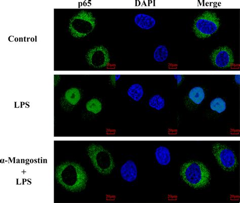 Effect of α mangostin on the LPS induced movement of NF κB subunit p65