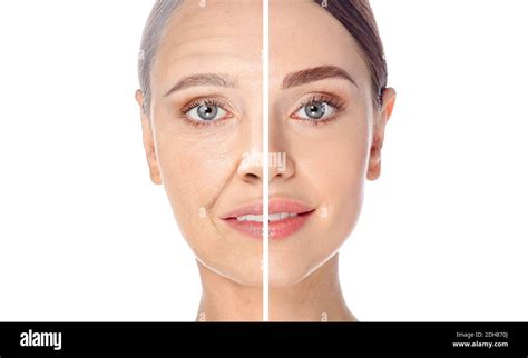 Facial aging process – Telegraph