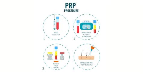 What is the difference between stem-cell therapy and PRP injection ...