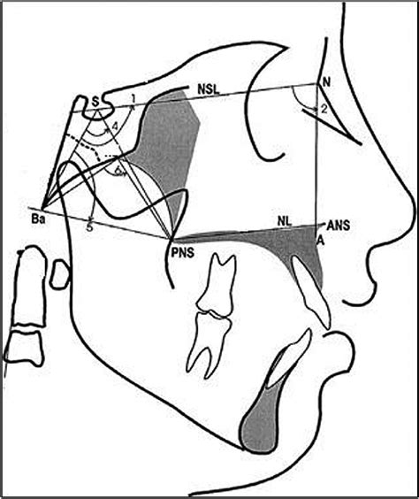 Nasopharyngeal Angular Measurements Download Scientific Diagram