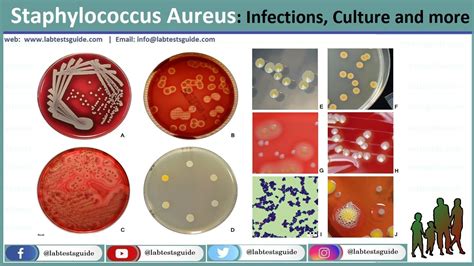 Staphylococcus Aureus Shape