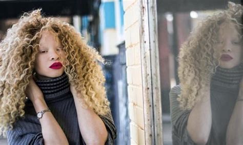 The albino beauty's uncommon look has helped her become a famous model