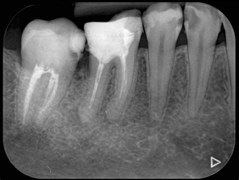 Radiologie dentară Clinica Doctor Lungu