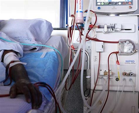 All About Peritoneal Dialysis Happiest Health