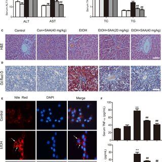 SAA Diminishes Alcoholinduced Liver Injury And Hepatic Steatosis A