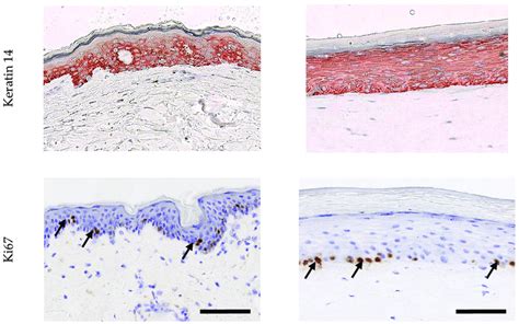 Characterization Of The Epidermis From Normal Human Skin Nhs And