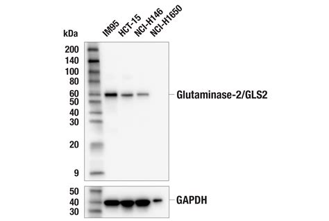 Glutaminase 2 GLS2 E9C7V Rabbit MAb Cell Signaling Technology