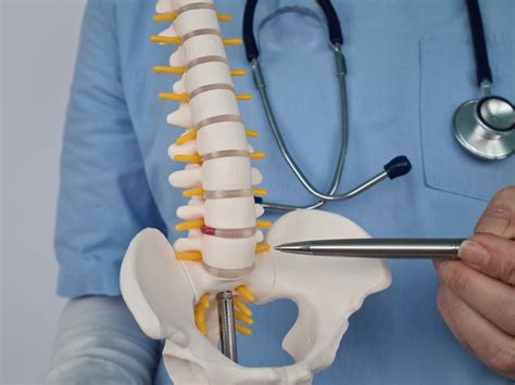DEGENERATIVE DISK DISEASE – Qban Health Care – Dominica