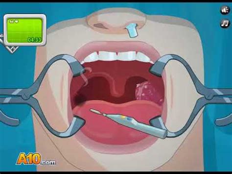 Operate Now Tonsil Surgery Gameplay Walkthrough Tutorial YouTube