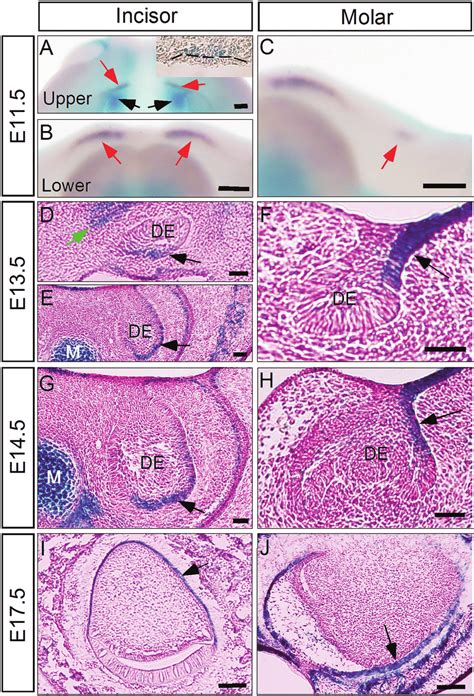 Expression Of Noggin In The Developing Tooth A C At E11 5 X Gal Download Scientific Diagram