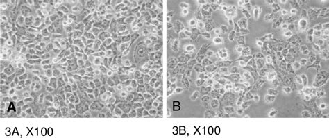 Morphological Changes Of Cal Cells Treated With Different