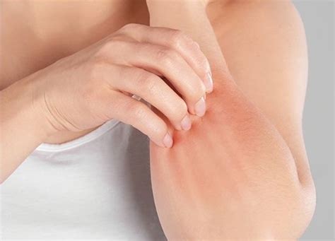 Skin Rashes Symptoms Causes And Treatments Home Remedies