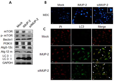 Effect Of Imup On Autophagy In Htr Svneo Trophoblast Depend On